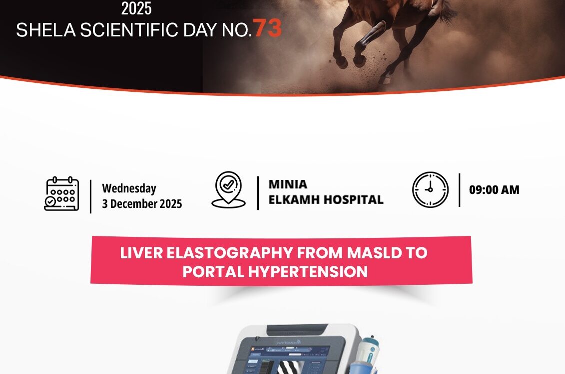 Liver elastography from MASLD to portal hypertension